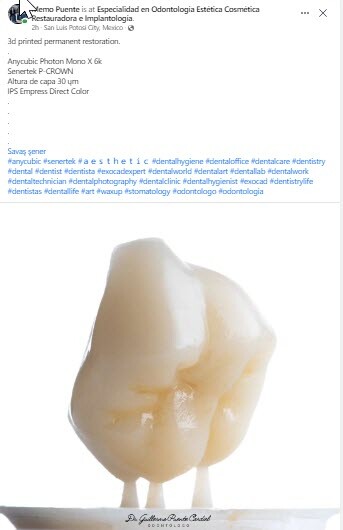 DLP SLA LCD 3d printer permenant crown - teeth resin ..