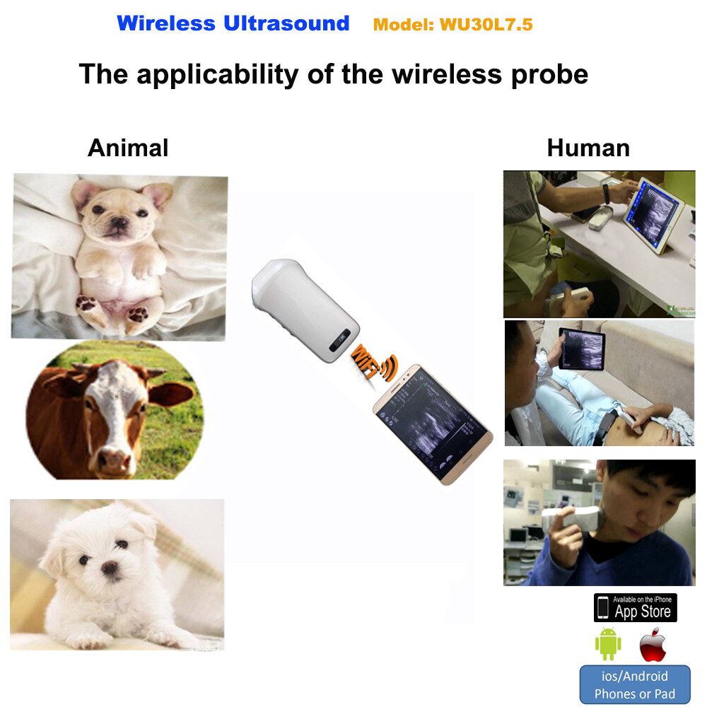 Handheld Wireless WiFi Linear Scanner Probes(lack & White), 7.5MHz, 128 Elements