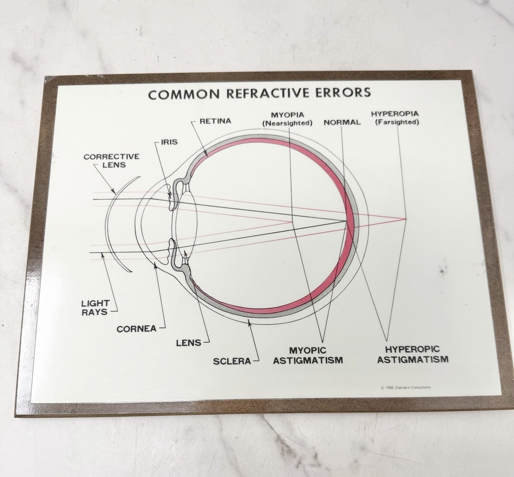 Vintage Optometry Eye Chart Board Common Refractive Errors Teaching Display