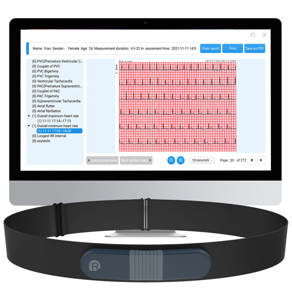 24 hours ECG/EKG Holter Monitor System with AI analysis Detects Afib PC Software