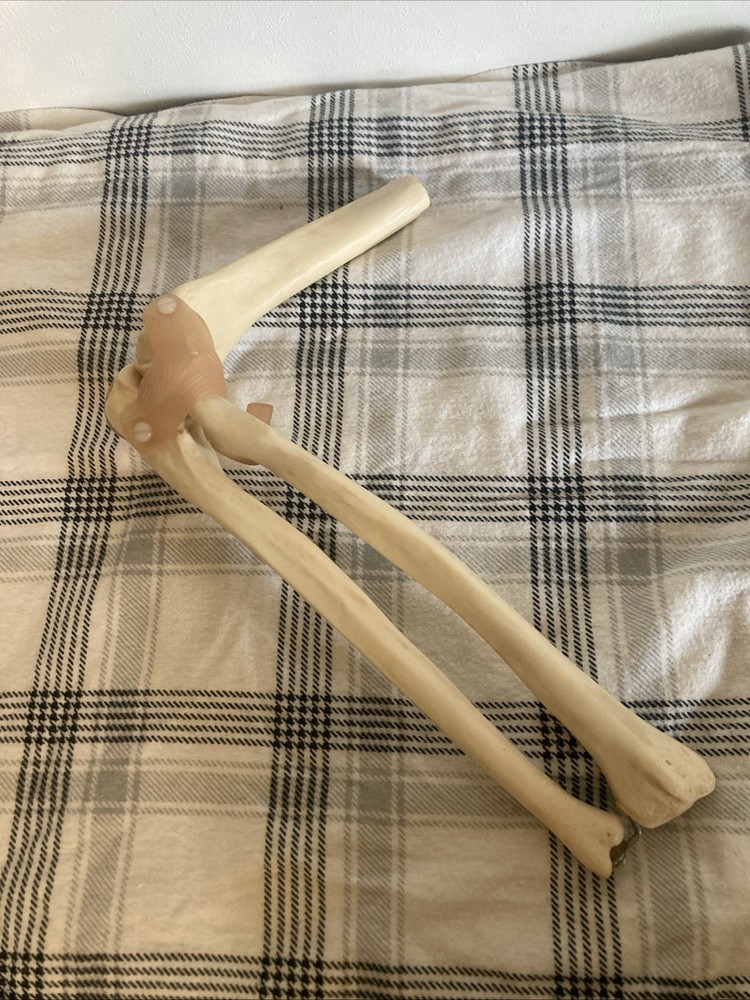 Somso Anatomical Elbow Joint Model. Read