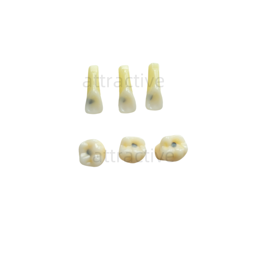 Dental Molar/Front Vitro Teeth Decay Caries Tooth Model Dentist Student Practise