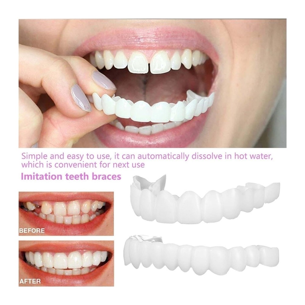 1 pair Temporary False Teeth Set – Natural-Looking Smile Enhancer for Confidence