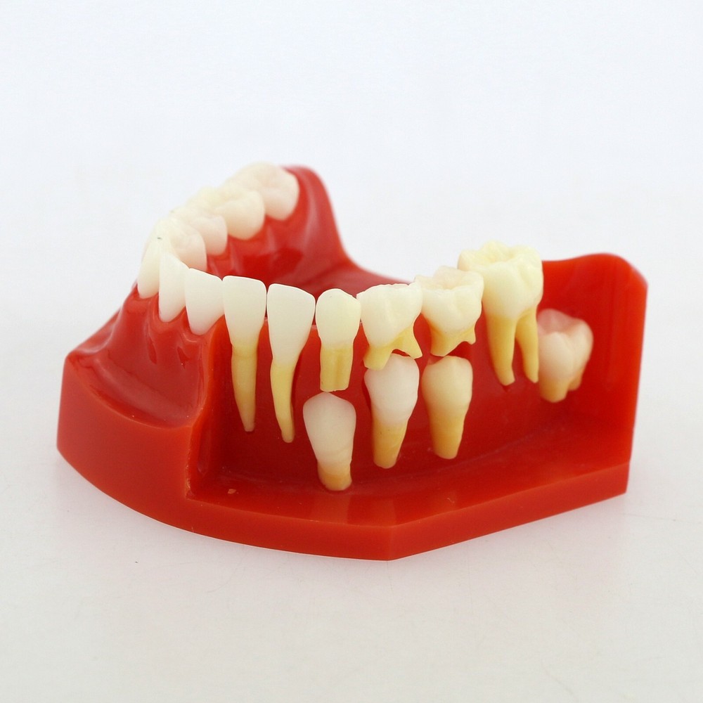Dental Teeth Permanent Tooth Alternate Demonstration Study Teaching Model 4006#