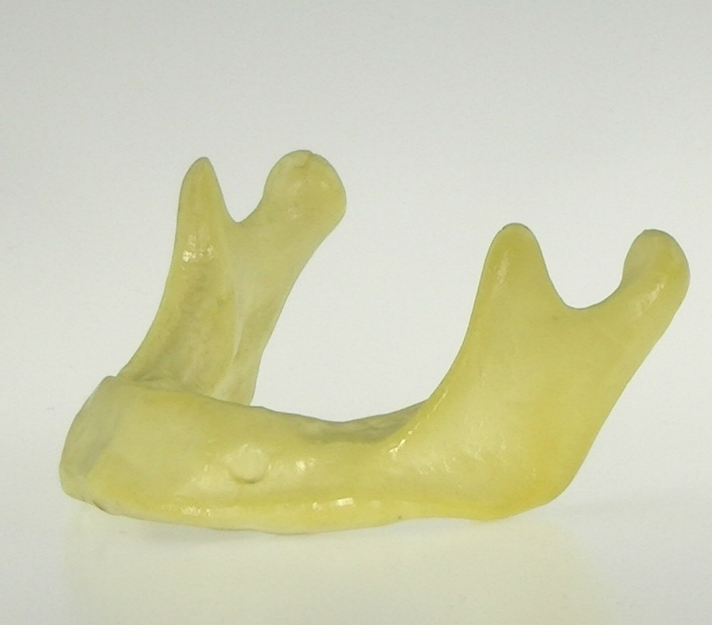 10PCS Dental Mandible Jaw Model for Basic Drilling Implant Insertion Practice
