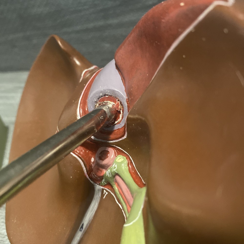 Somso Liver On Adjustable Stand Model - Numbered - Damaged