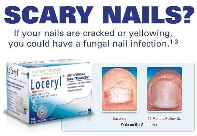 (The Latest ) # Nail Fungal Lacquer 2.5ML FREE & FAST SHIPPING World Wide