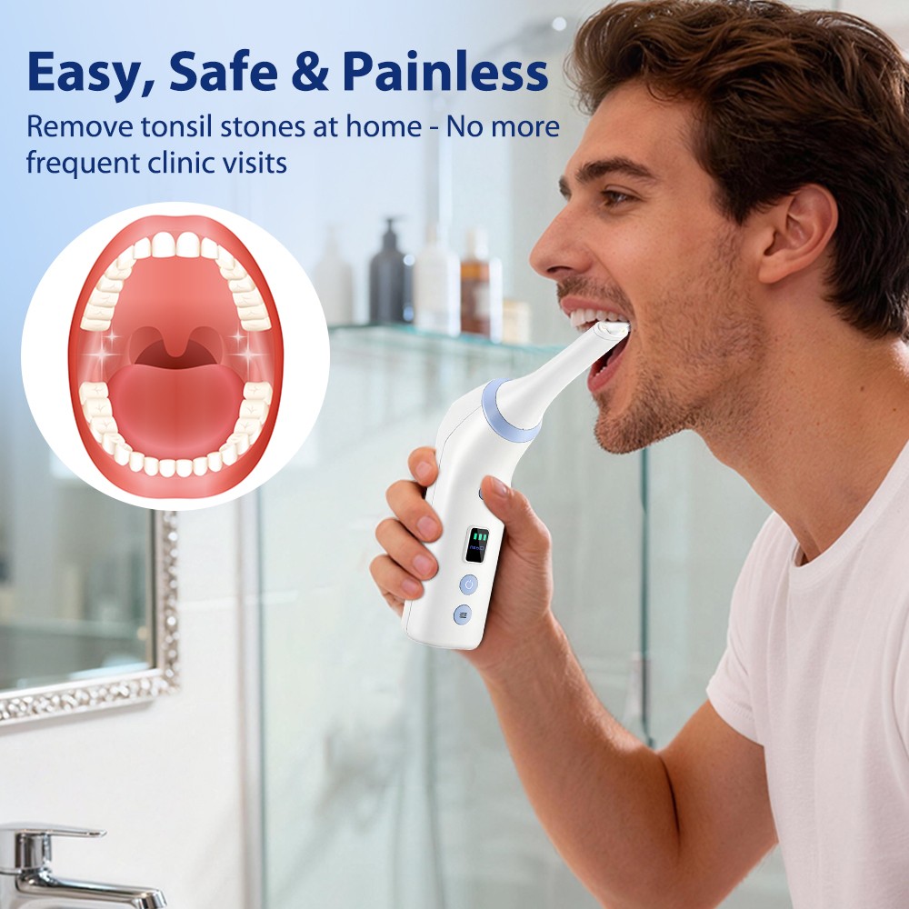 Electronic Tonsil Stone Remover Kit with LED Light & 3 Adjustable Suction Modes