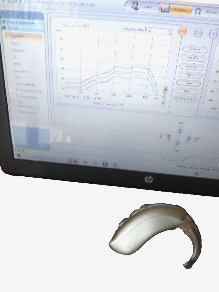 PROGRAMMABLE DIGITAL HEARING AID PROFOUND LOSS . 2 mics 3 programs WE PROGRAM