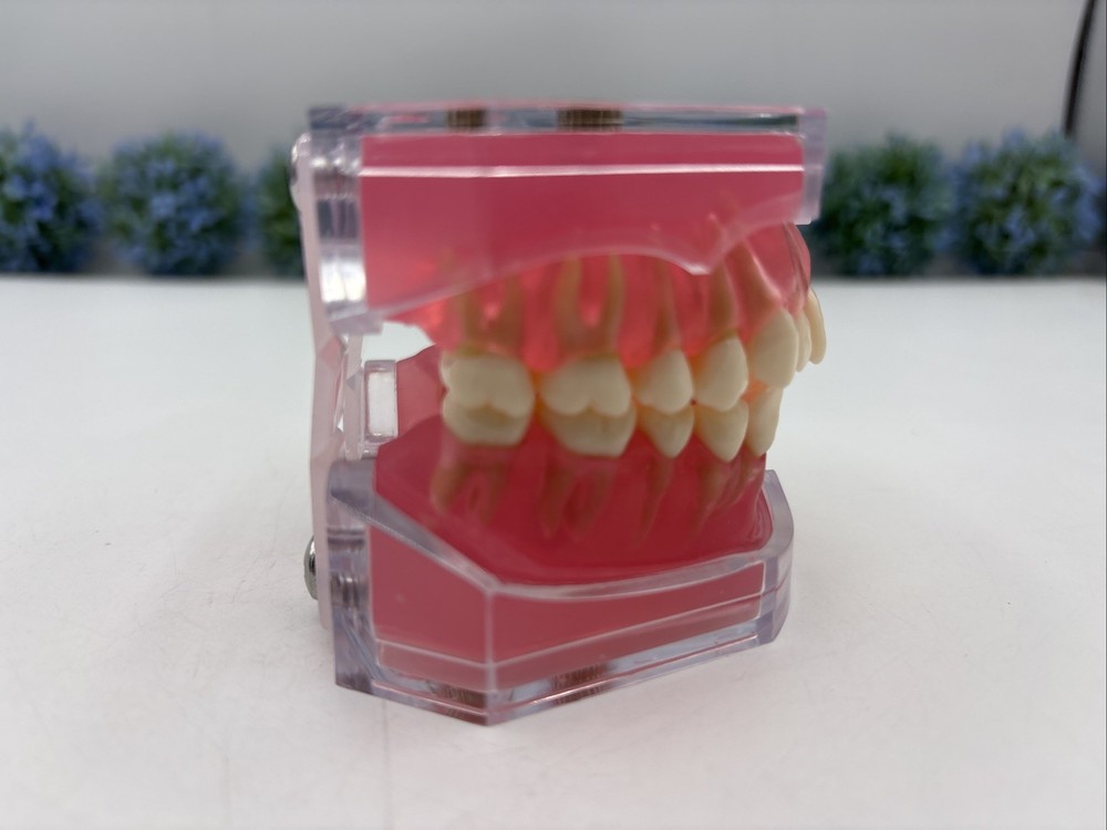 Dental Typodont Practice Removable Teeth Model M7008
