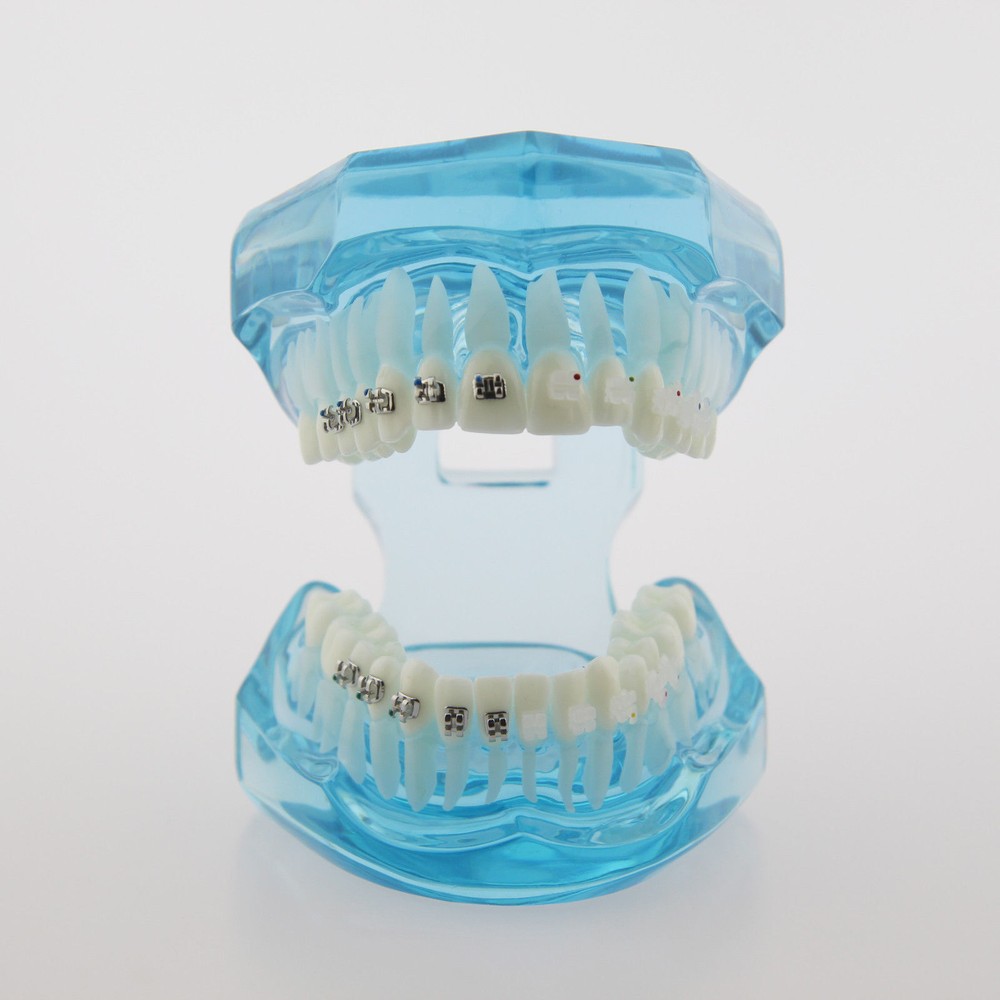 Dental Teach Study Typodont Teeth Model Half Metal Bracket Half Ceramic Bracket