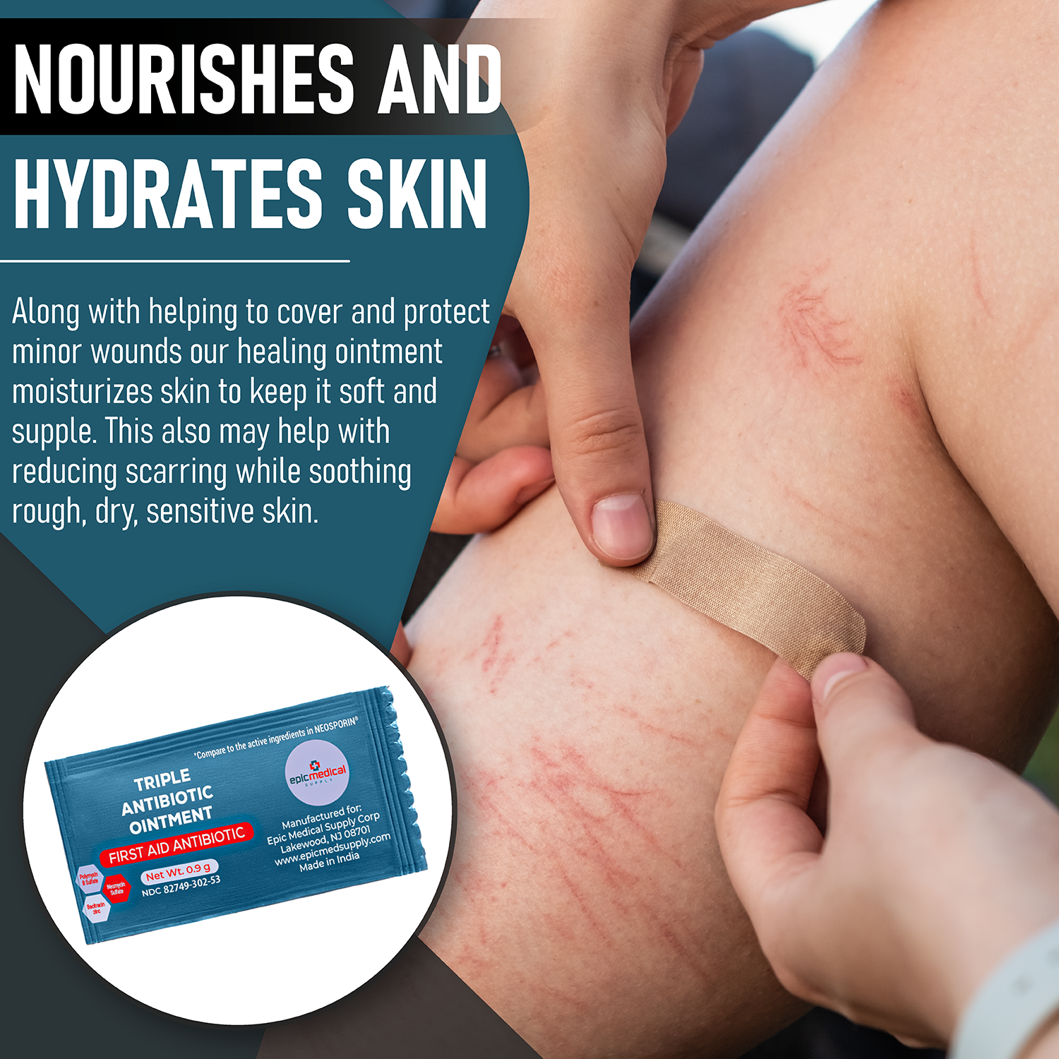 Epic Medical Supply Triple Antibiotic Ointment .9g Packets 144 Per Box