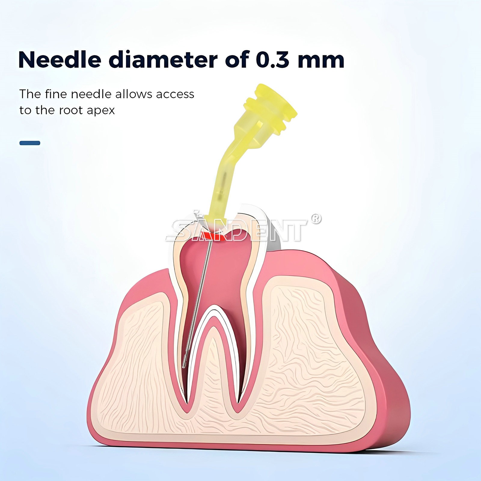 Dental Endodontic Endo Irrigation Needle Tip Disposable Root Canal Syringe Tips