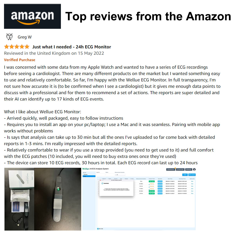 US stock Wellue Portable Dynamic ECG EKG Holter Recorder 24 Hours PC AI analysis