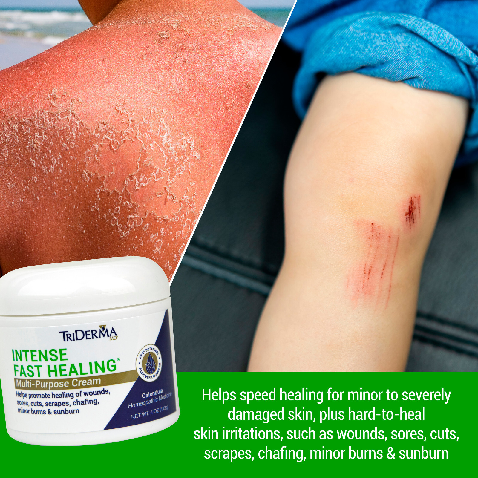 TriDerma Intense Fast Healing Multi-Purpose Cream (4 oz)