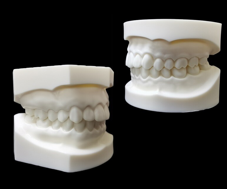 1pc Dental Caries Tooth Care Analysis Models Study Teaching Teeth Model 28/32T