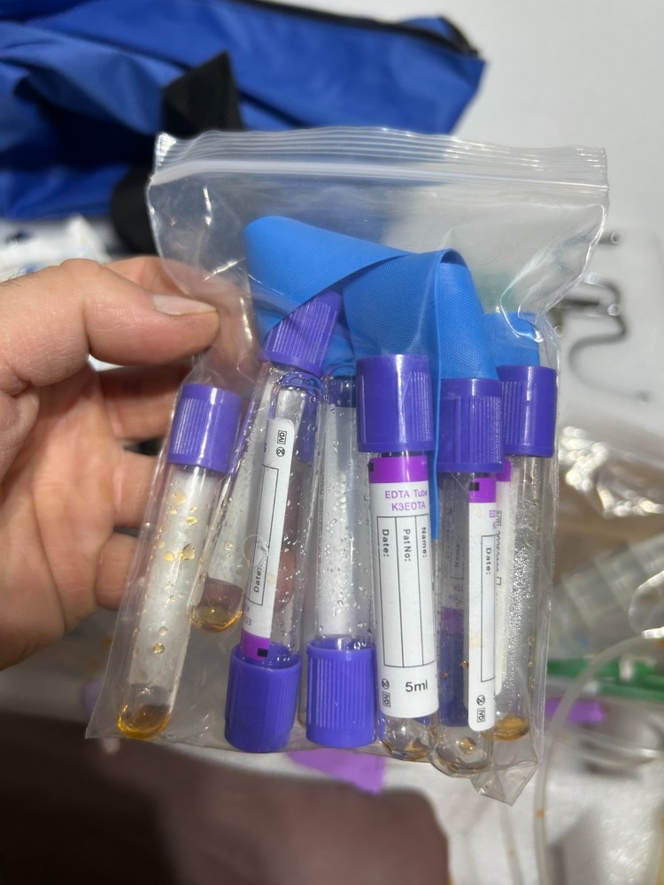 Phlebotomy Training Kit | IV, Venipuncture Arm Practice Kit EDUCATIONAL-USE