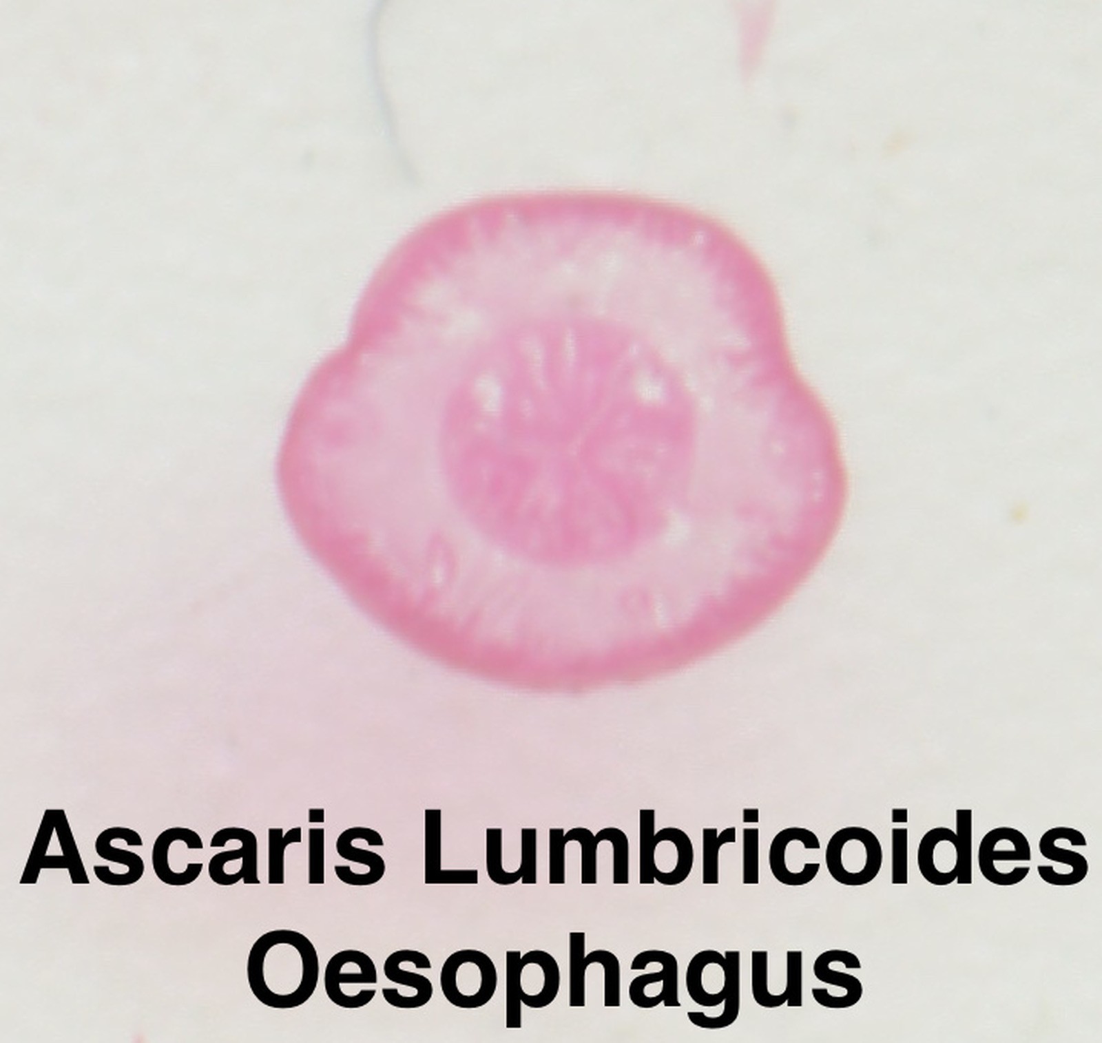 Parasite Microscope Slide Set Deadly Disease Insect Whole Mount Helminth Worm