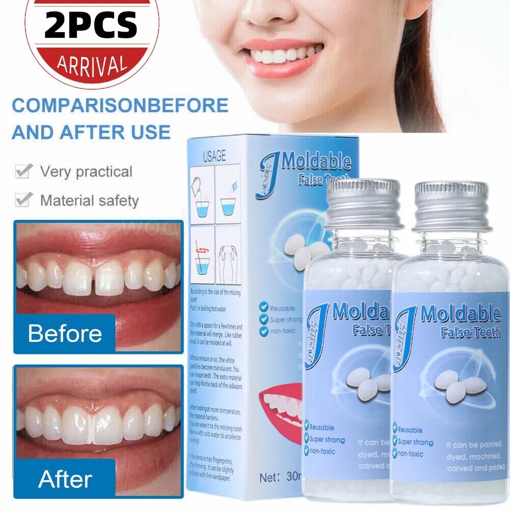 2~ Tooth Repair Kit - Temporary Teeth Replacement Kit for Missing & Broken Teeth