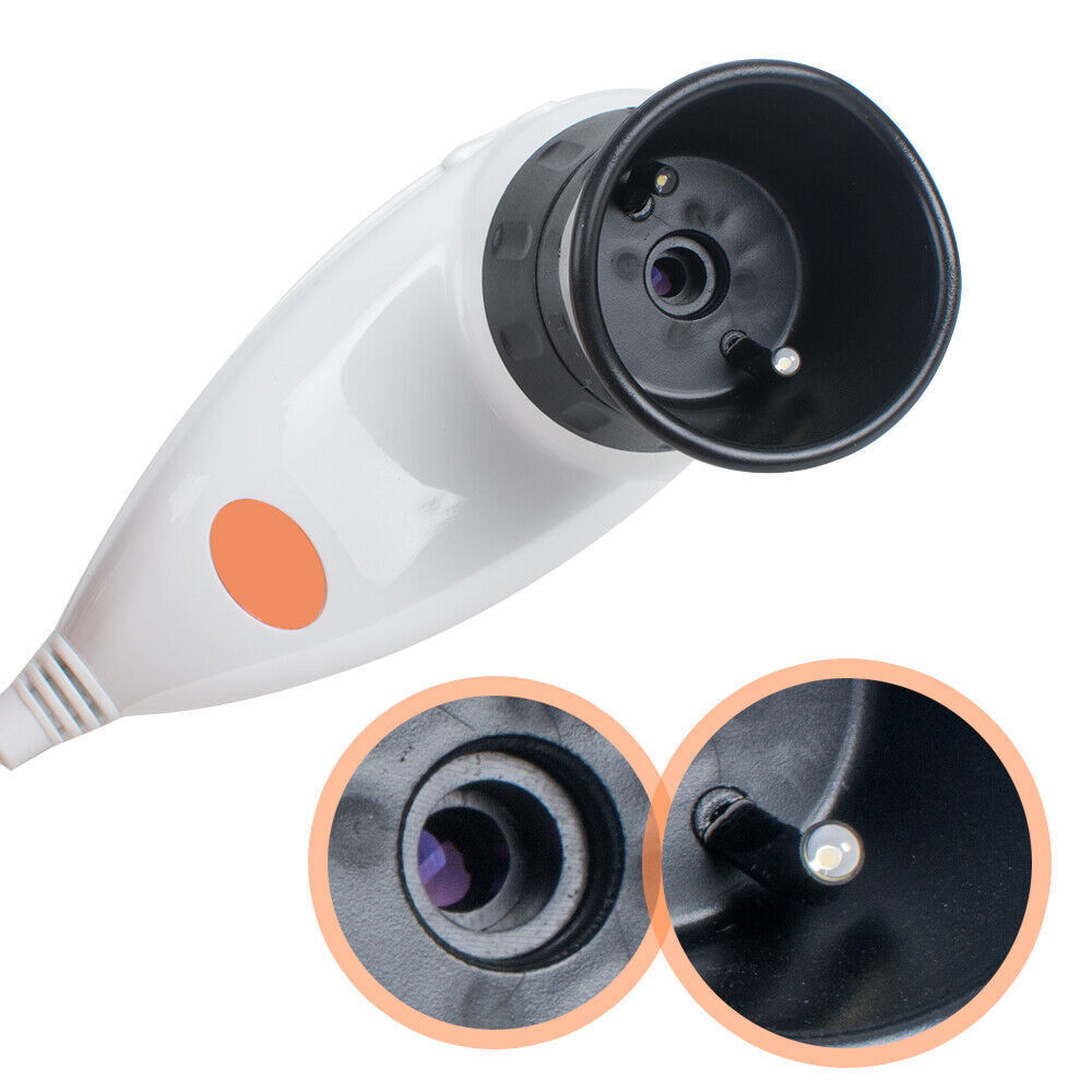 USB Digital Eye Iriscope Iridology Camera Analyzer System 5MP High Resolution